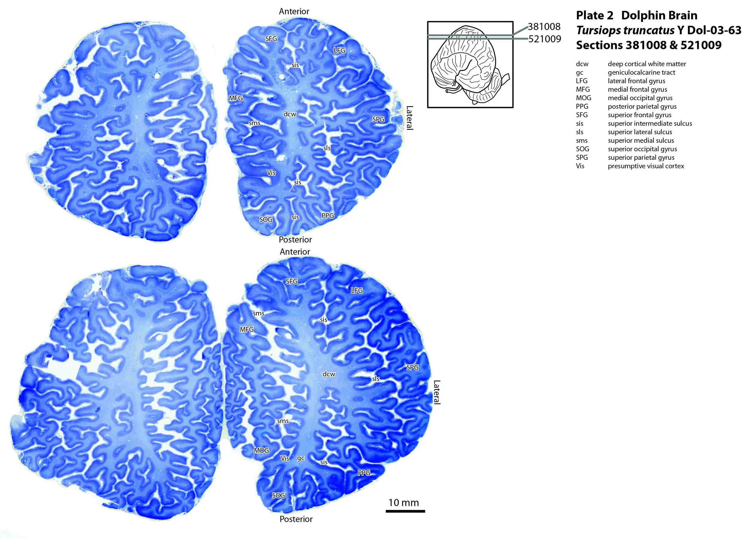 Atlas of the Brain of a Dolphin — Comparative Brain Anatomy